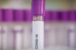 A Covid-19 Blood Sample in test